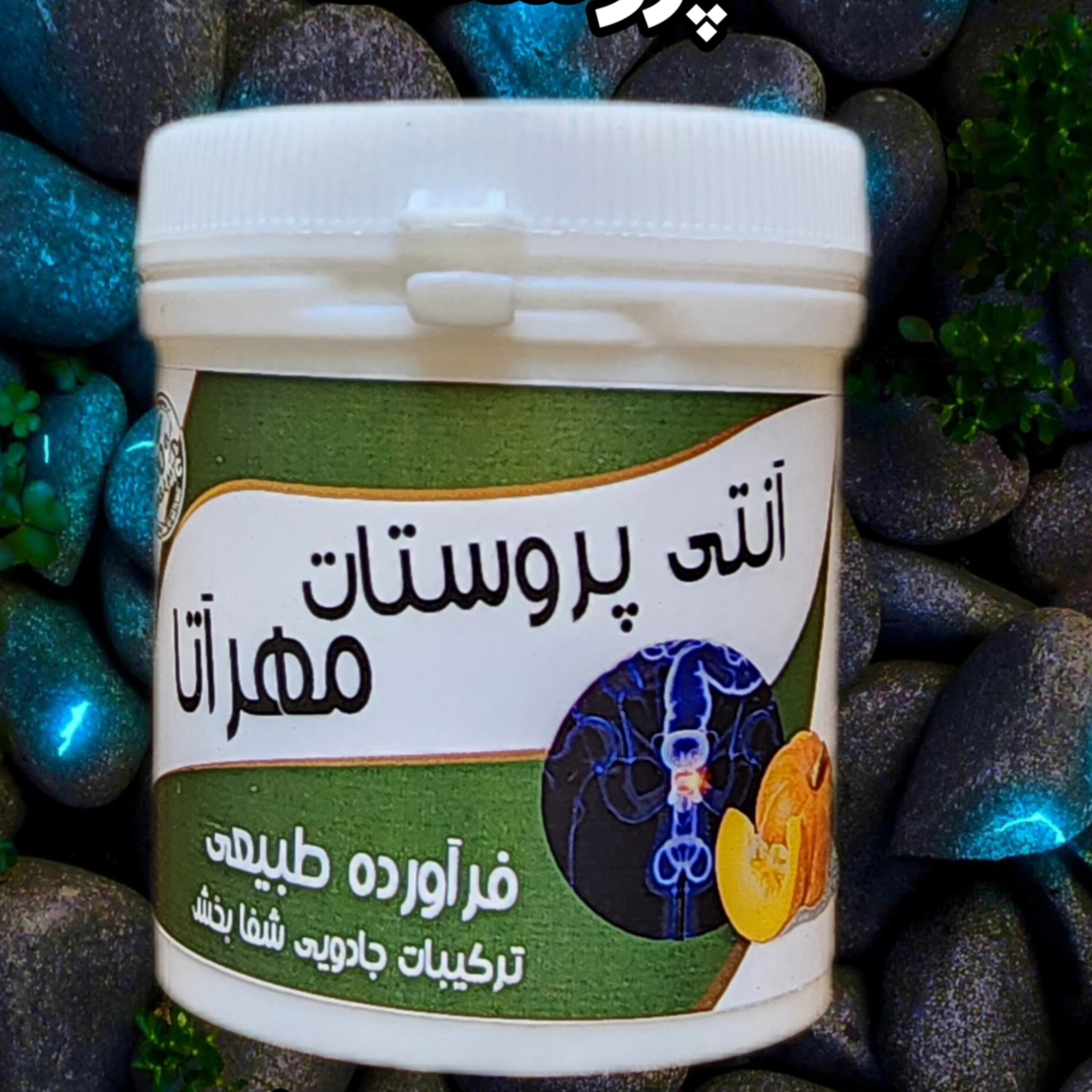 آنتی،پروستات